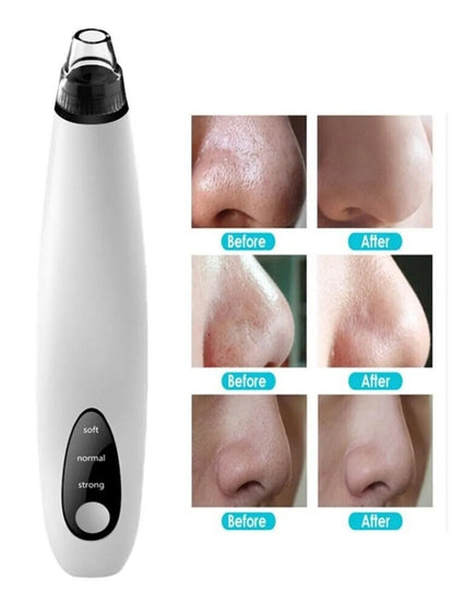 White and black electronic device with before and after skin comparison images on a white background