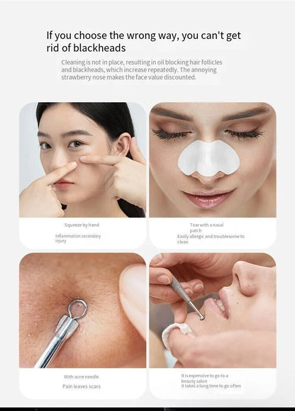 Educational diagram showing incorrect methods of removing blackheads with corresponding images and text.