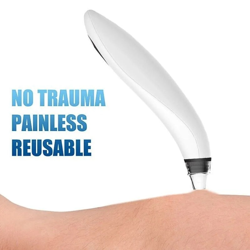 Skin care device with text 'No trauma, painless, reusable' on a white background