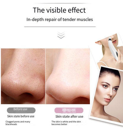 Before and after effect of skin treatment on a nose, with a woman's face on the side.